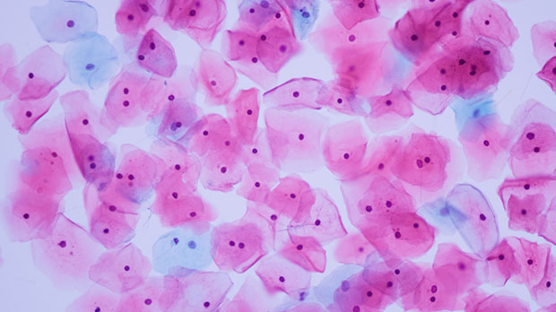 Normal squamous epithelial cells from the cervix under the microscope