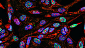 Cancer cells growing in 2D, labelled with fluorescent markers
