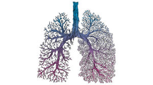 TRACERx EVO, a new programme to transform lung cancer research - Cancer ...