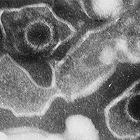 electron microscopic image of two Epstein Barr Virus particles