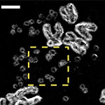 ecDNAs clustering together between chromosomes