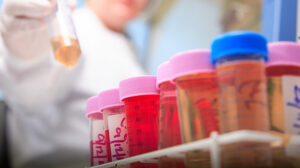 A scientist handling patient samples at an experimental cancer medicine centre.