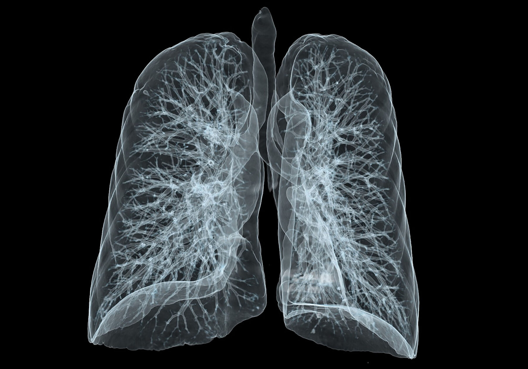 A CT scan of someone's lungs