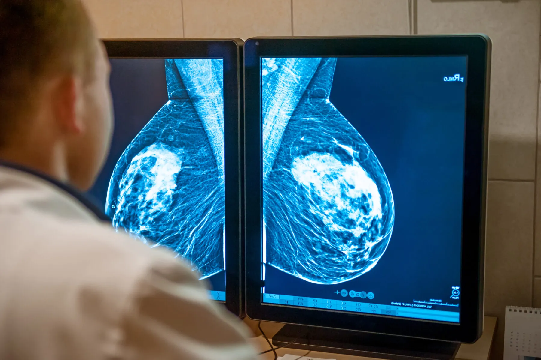 A doctor examining a mammogram.