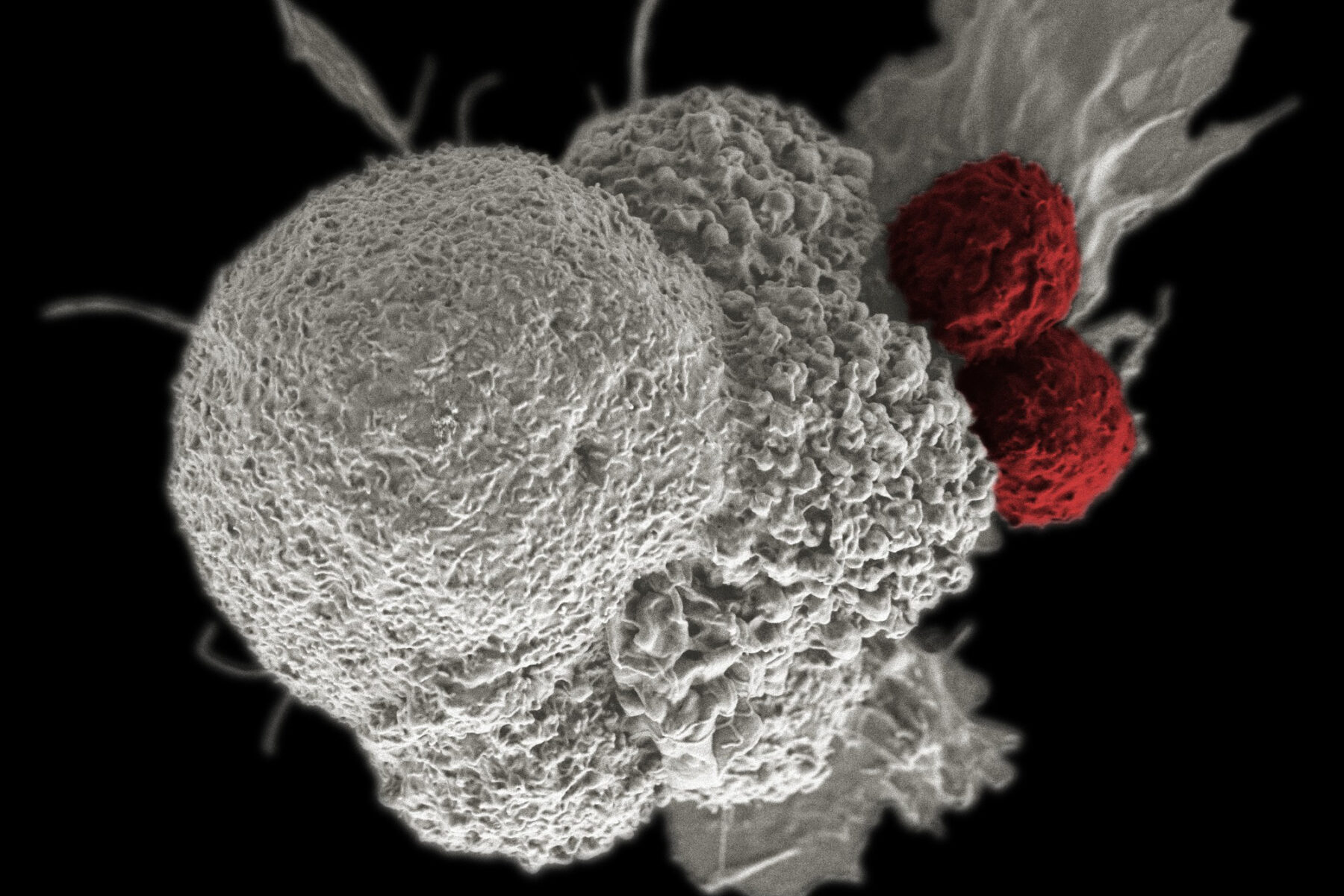 Microscopic image of T-cells attacking cancer cells.