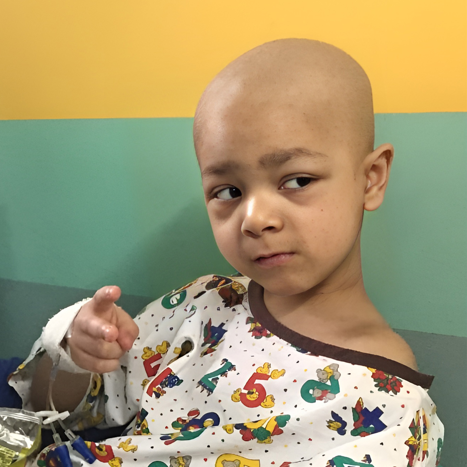 A picture of Abdullah after surgery to remove his neuroblastoma.