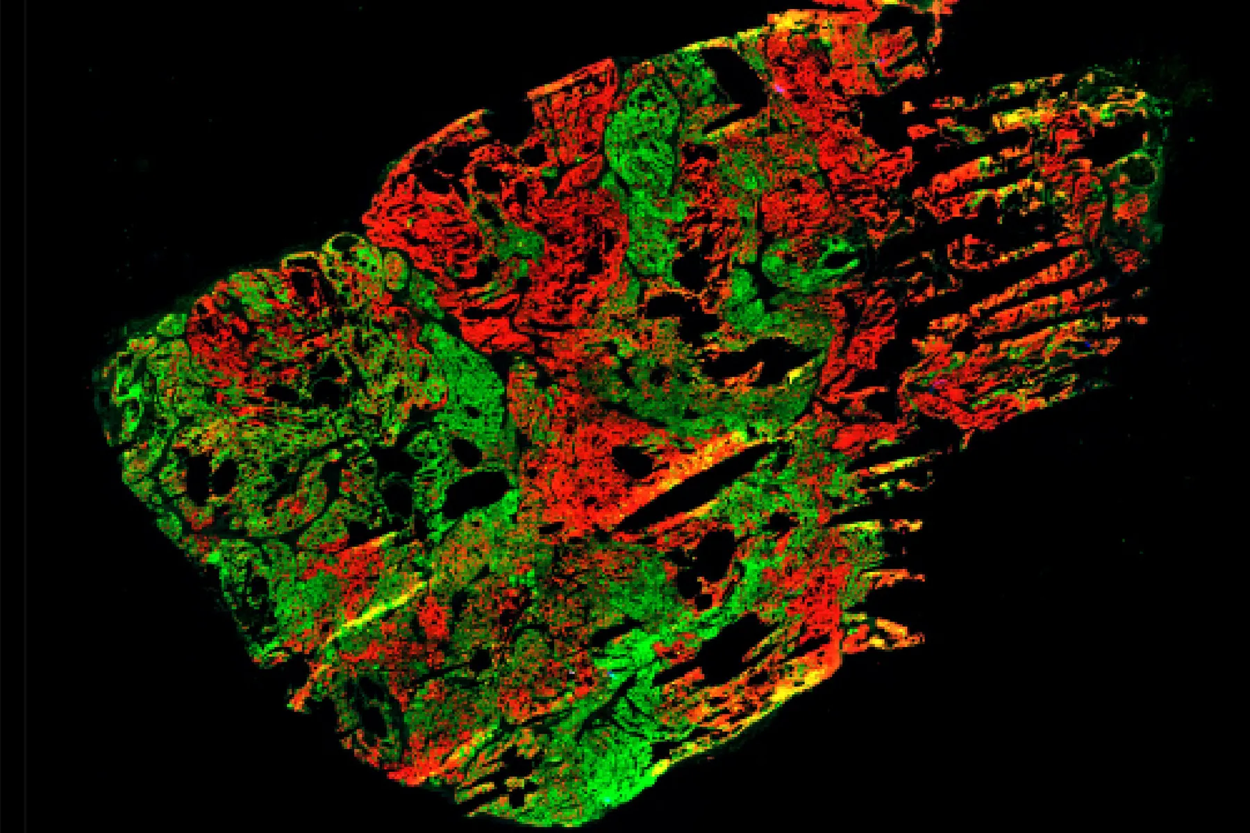 A sample of a mouse model of a tumour seen through team Rosetta's tools.