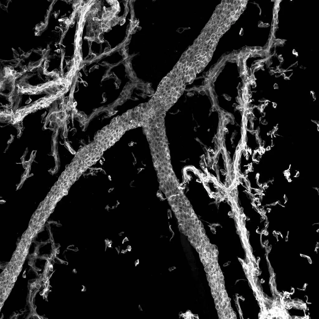 Super-resolution 3D bile ducts