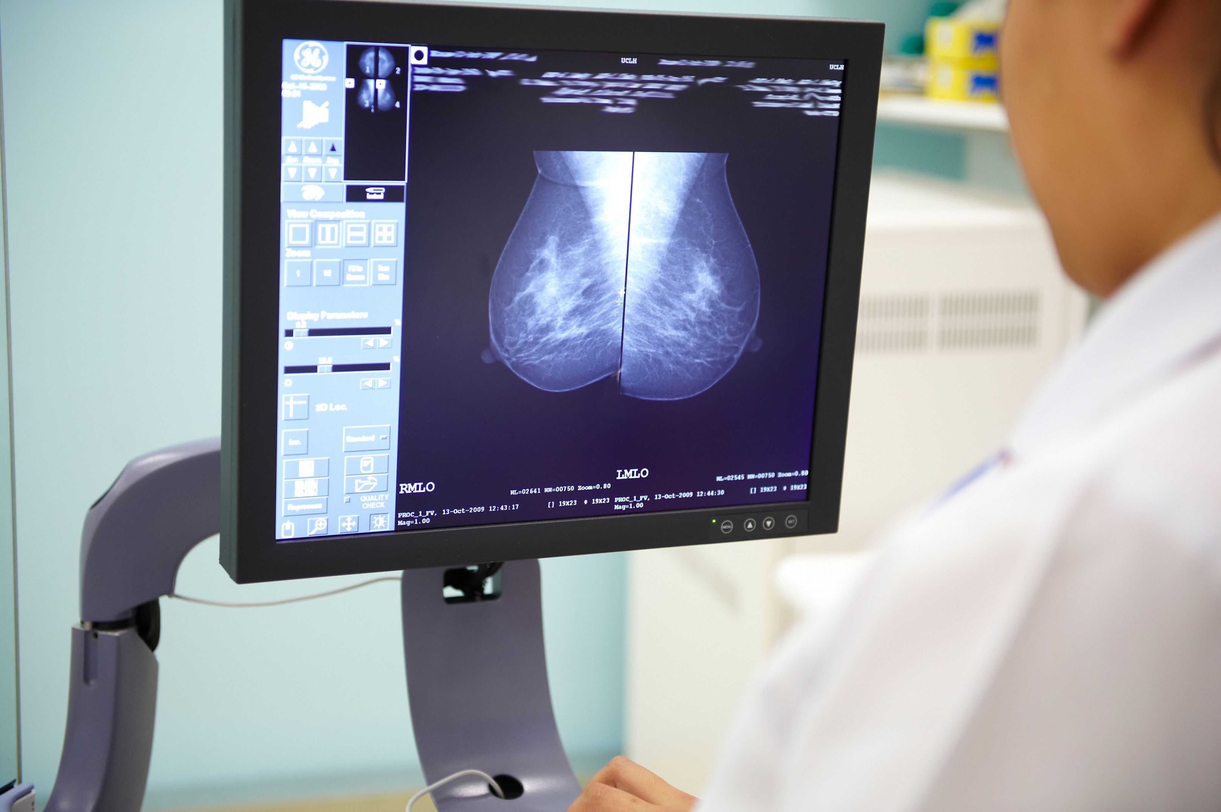 A radiographer looking at a mammogram