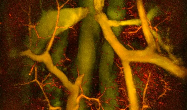 3D image of blood vessels highlighted