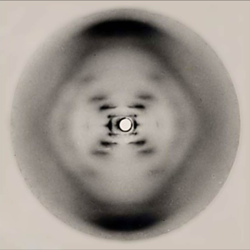 A black and white x-ray image showing a faint, stepped 'X' shape in a clouded circle. 