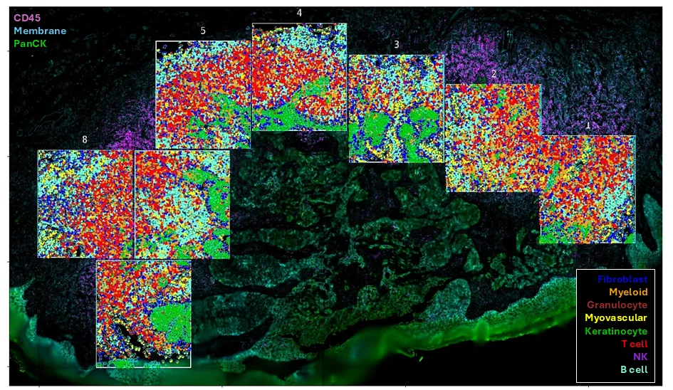 spatial transcriptomics