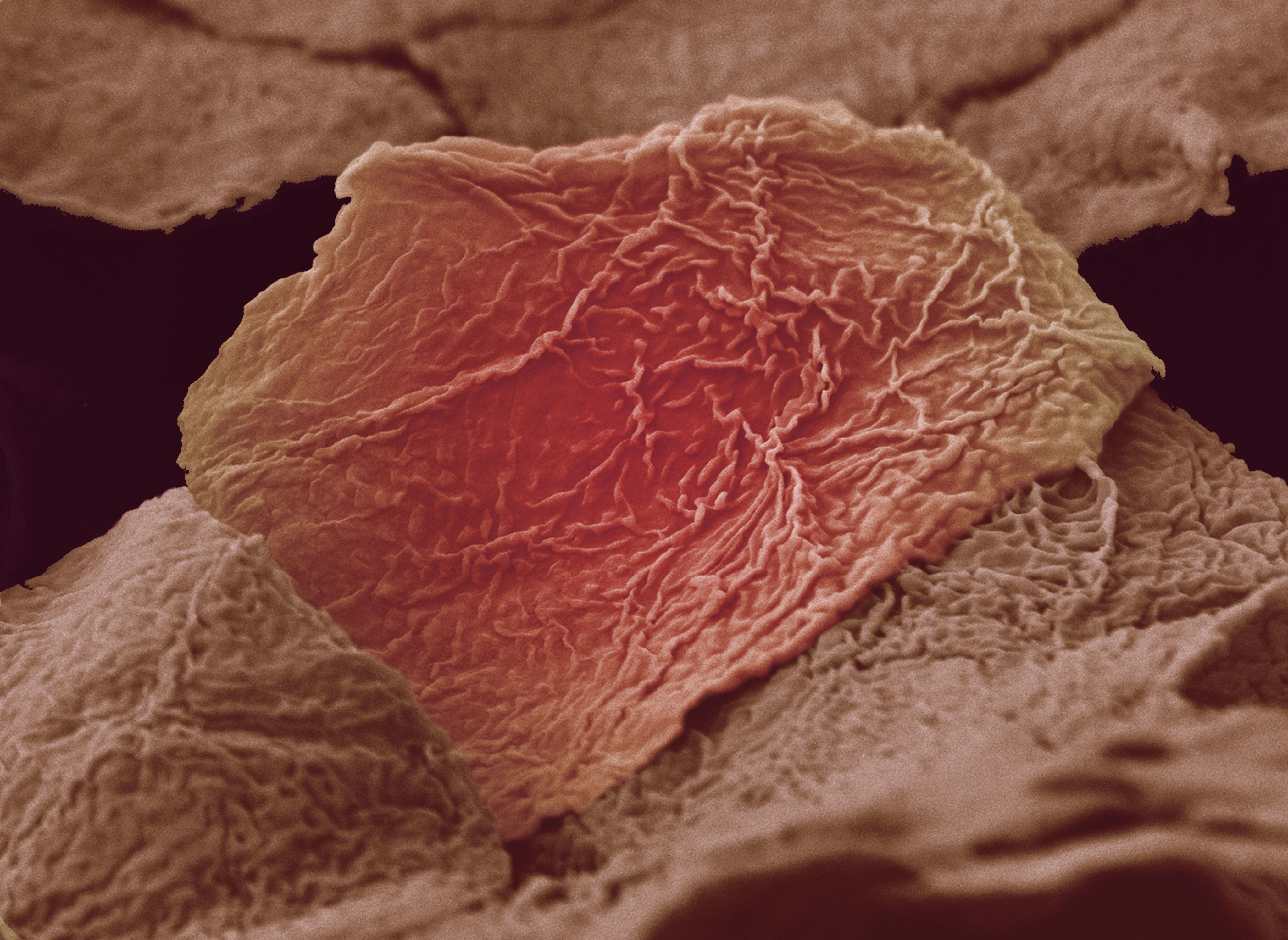 Bright red burn damage visible on squamous skin cells through a microscope.