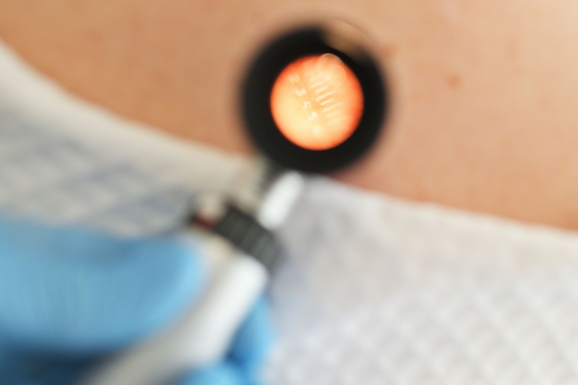 A dermatoscope, a special tool doctors use to look at marks on people's skin.