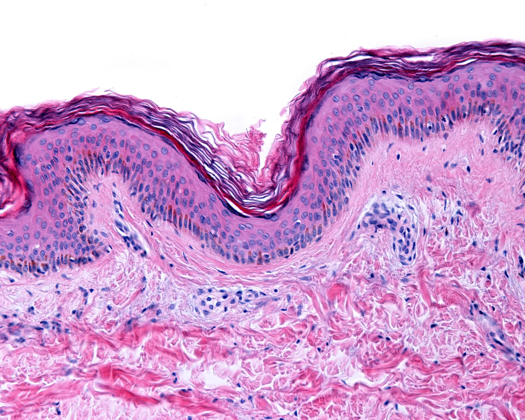 Microscope image showing the cells in different layers of skin. It appears pink, blue, purple and red.