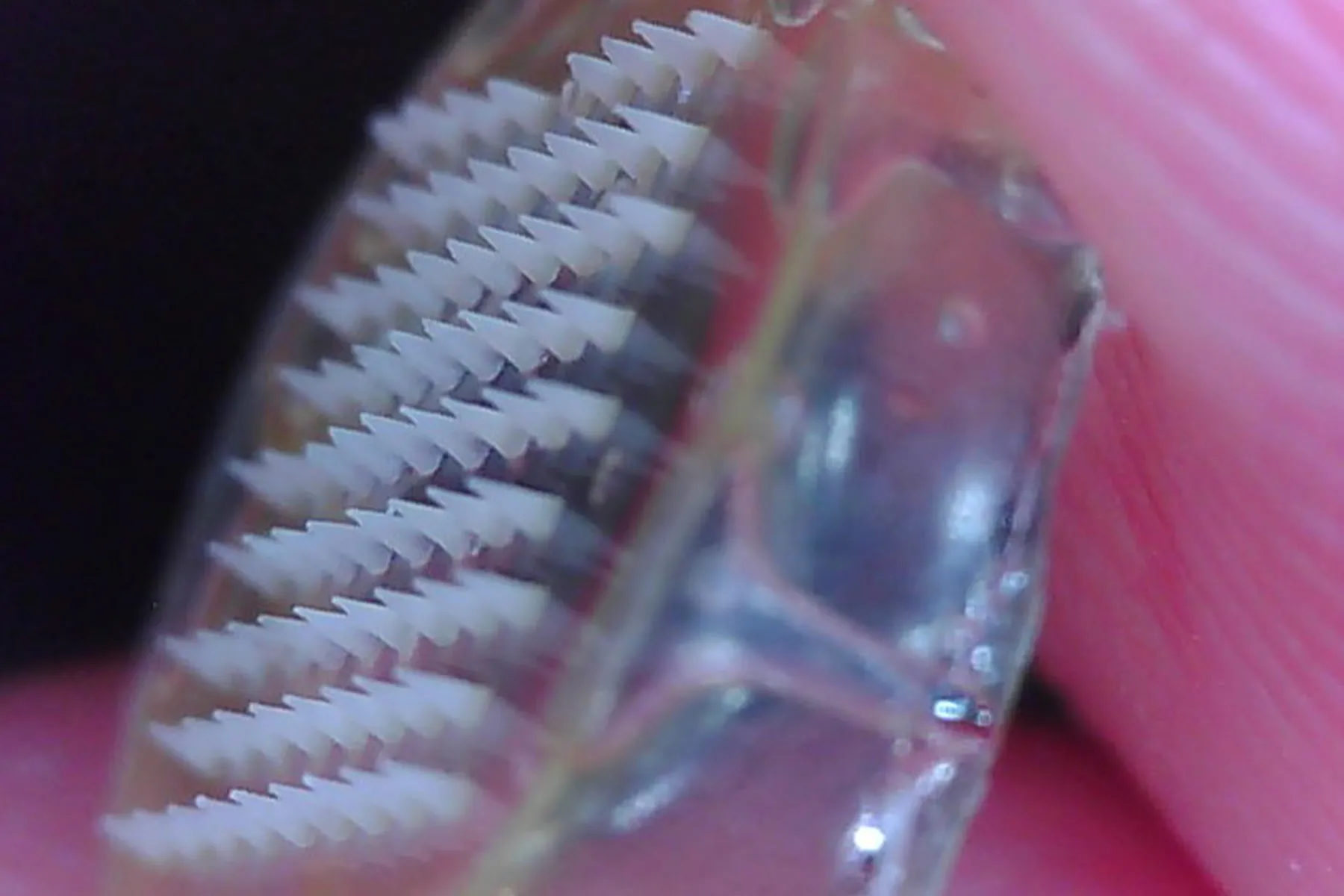 An extreme close-up of a skin patch that could help diagnose skin cancer held between someone's finder and thumb. The skin patch is transparent, and one side is covered with a grid of tiny needles.