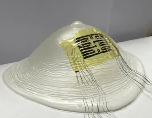 Silicon breast with a yellow patch
