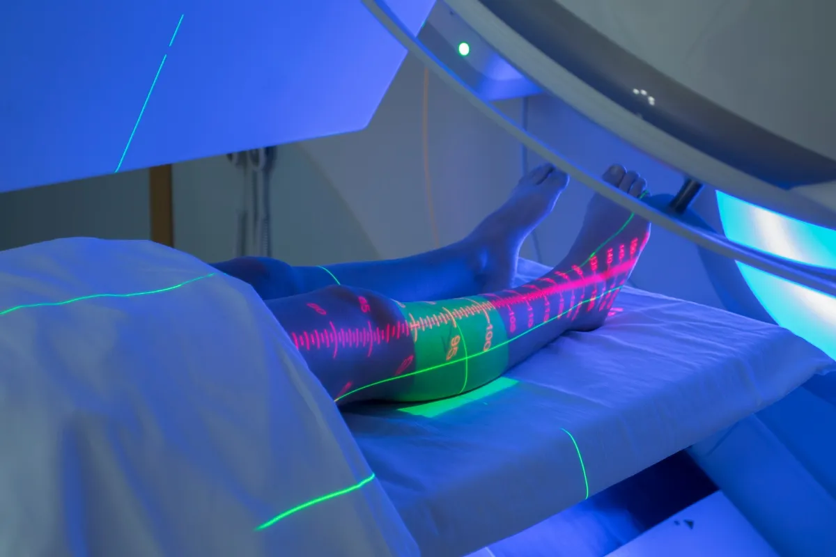 A young woman receiving radiotherapy.