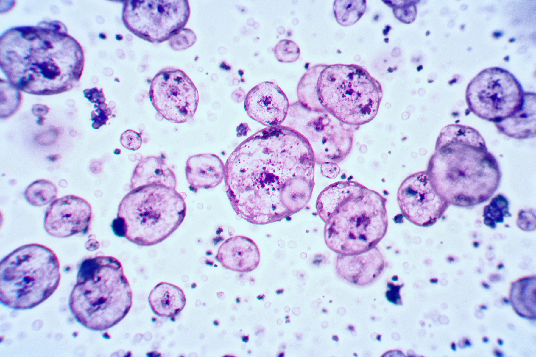 A cluster of different sized pink cells seen through a microscope.