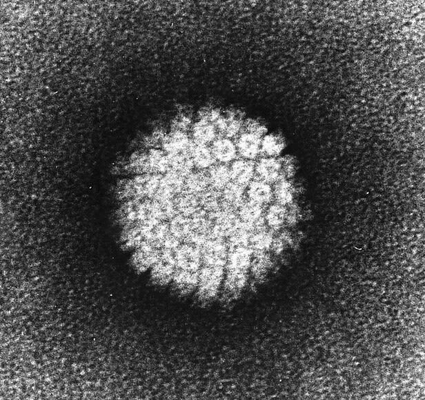 Electron micrograph of a negatively stained human papillomavirus (HPV)