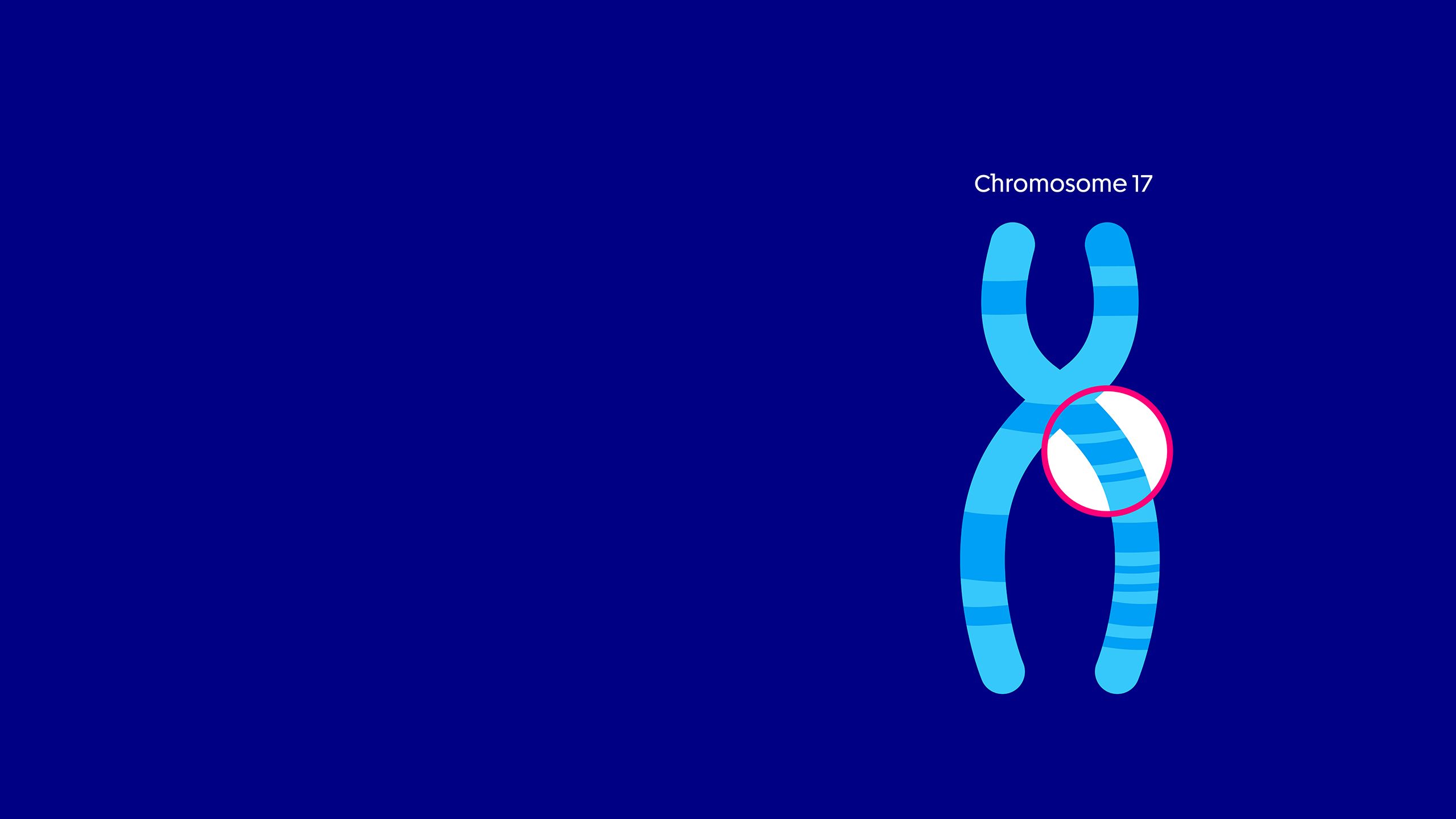 Diagram of chromosome 17 with a small area highlighted