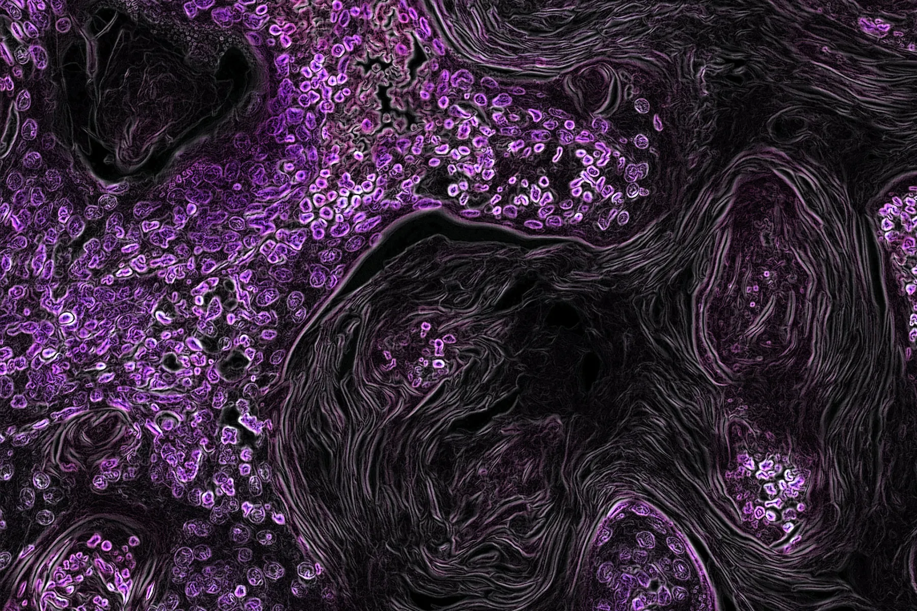 A computer generated microscopic image of purple lung cancer cells with a genetic mutation.