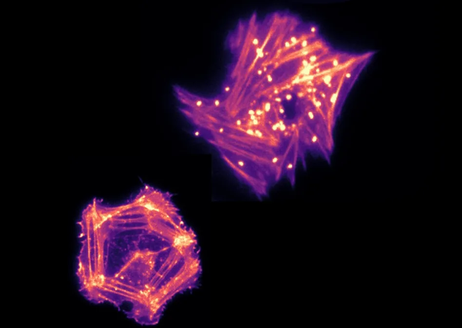 megakaryocytes