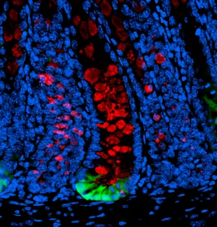 Fluorescent micrograph image of a section from a mouse colon with green stem cells, red and blue cells surrounding against black background