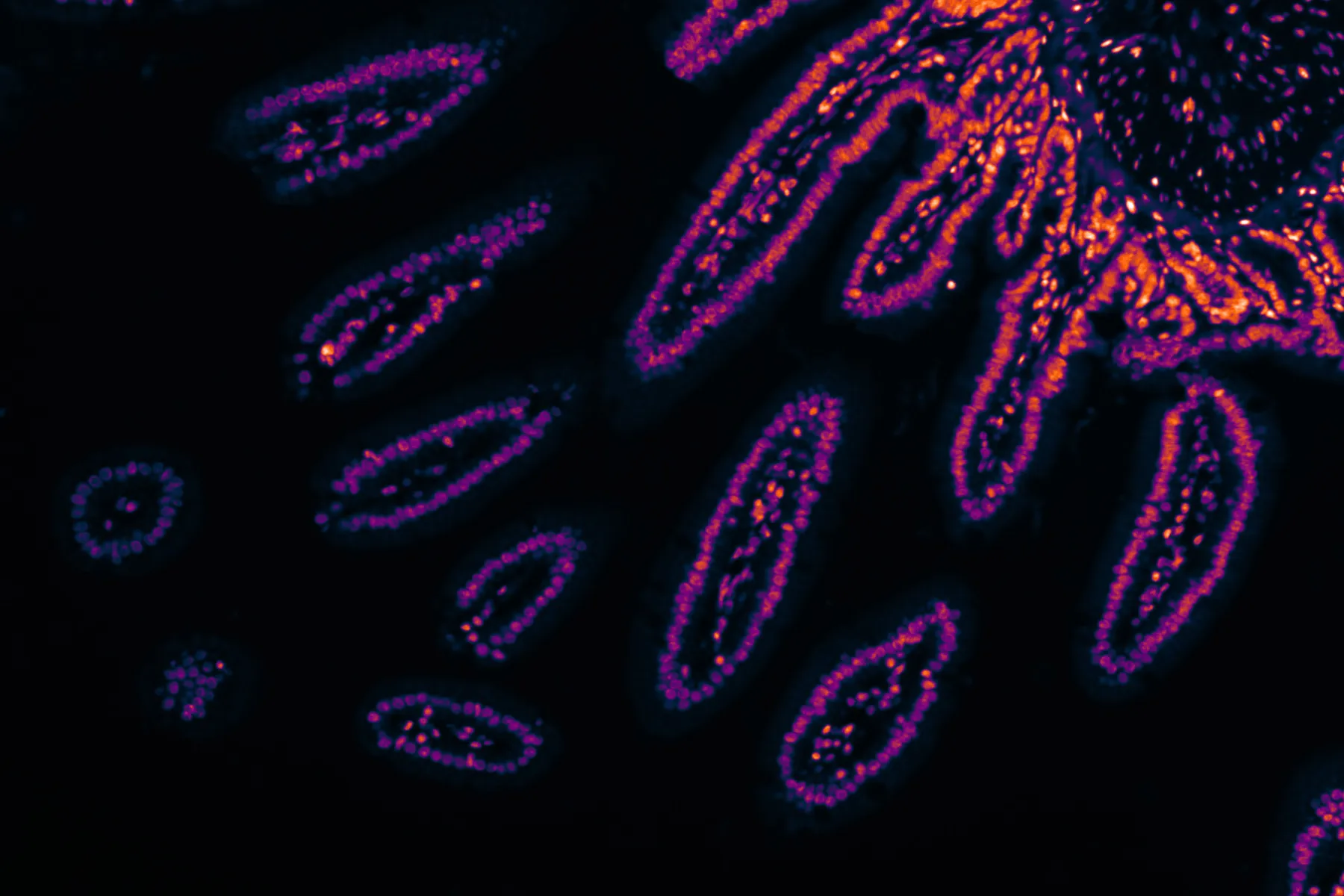Fluorescence microscopy image of pink and purple bowel cells against a black background
