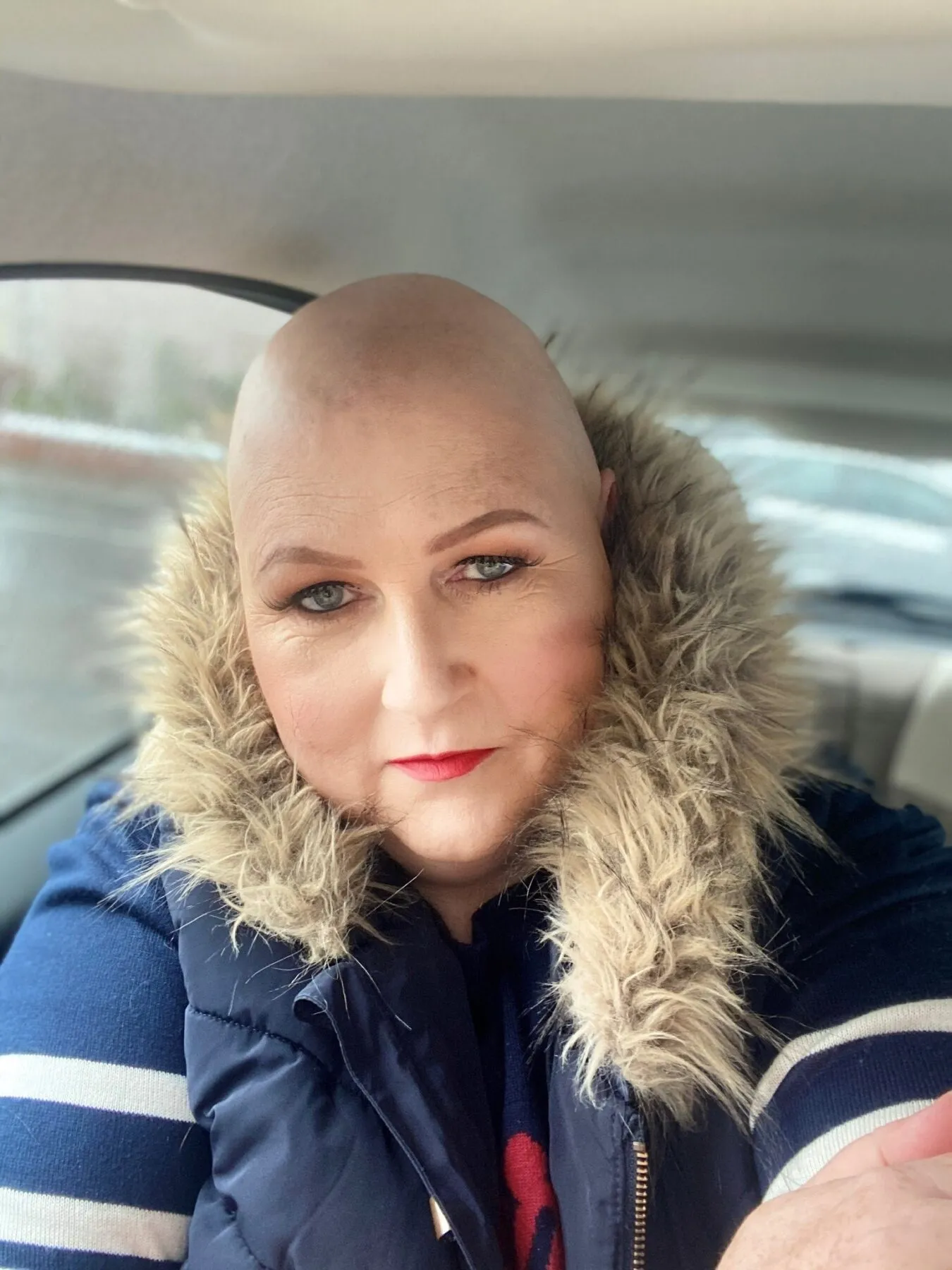 Jo during her treatment