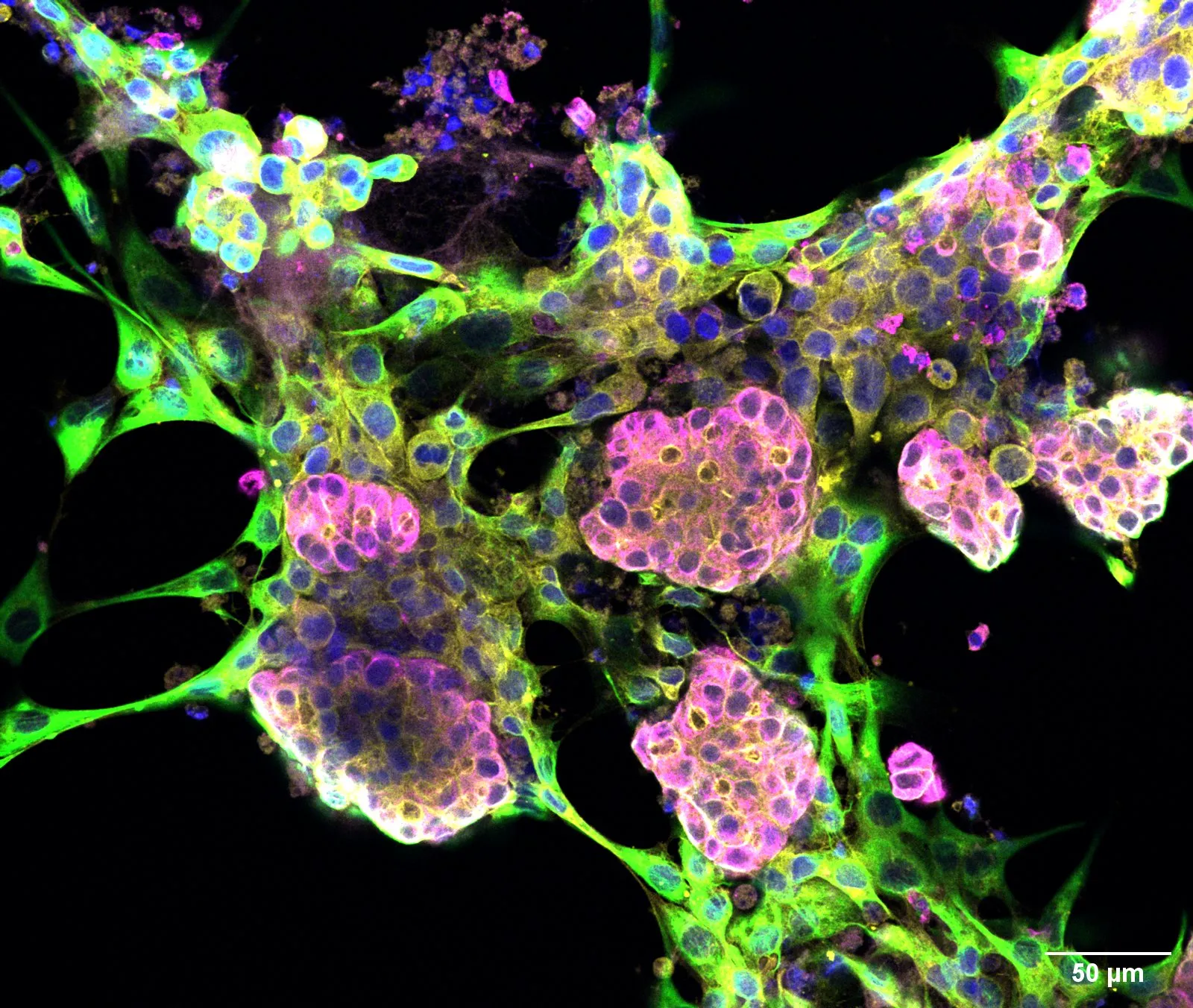 Ovarian cancer organoid