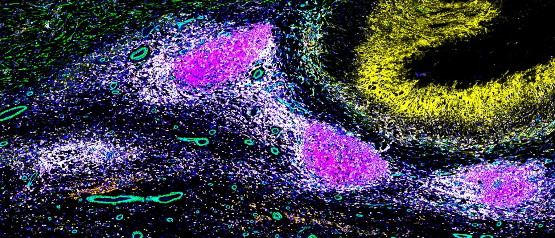 immunofluorescence image of human neuroblastoma