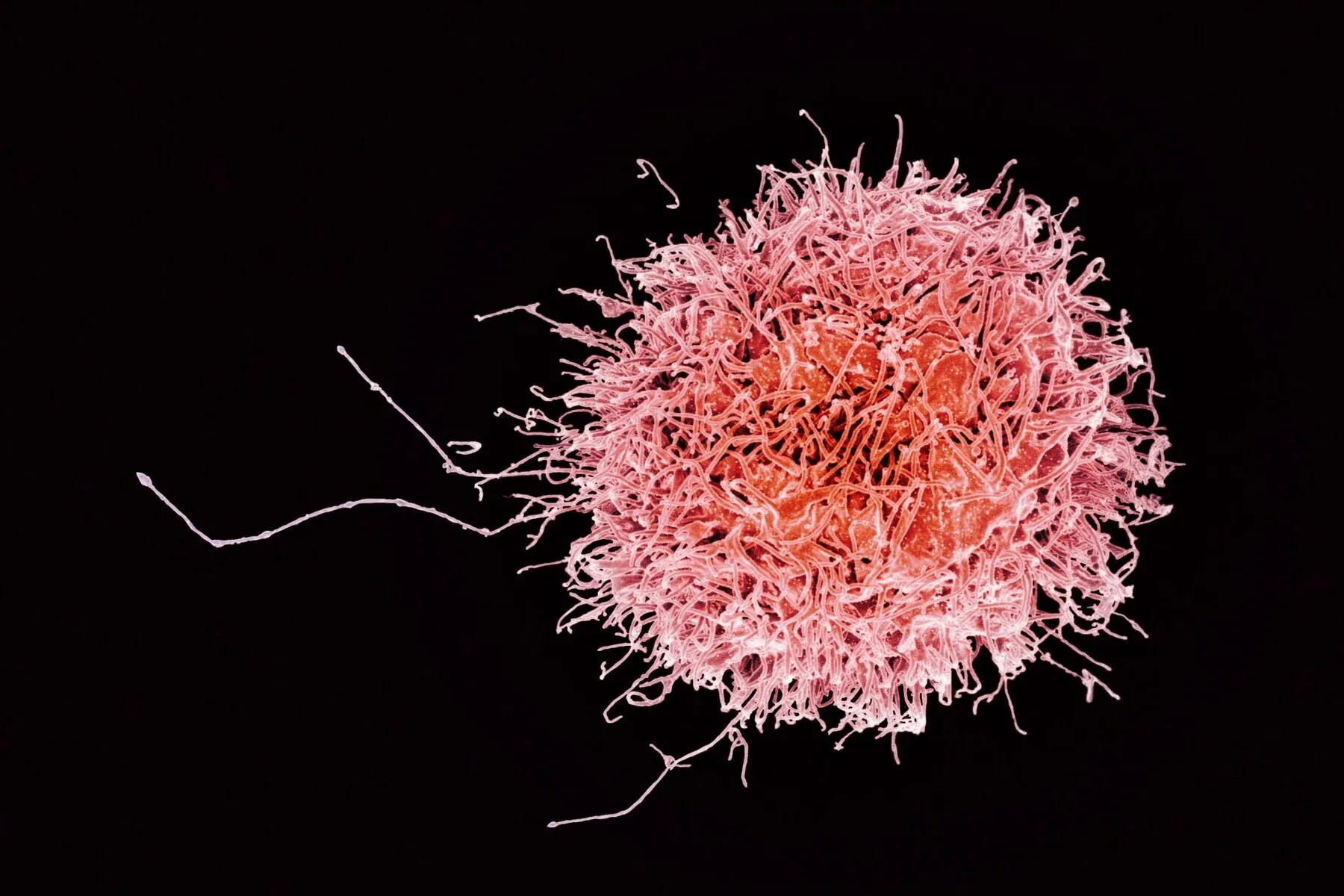 A microscopic image of a natural killer cell, a type of immune cell important for protecting against myeloma.